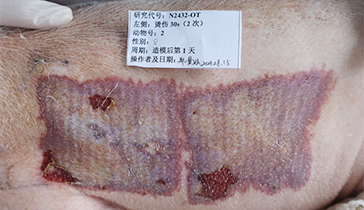 Deep Partial-Thickness Scald Burn Model